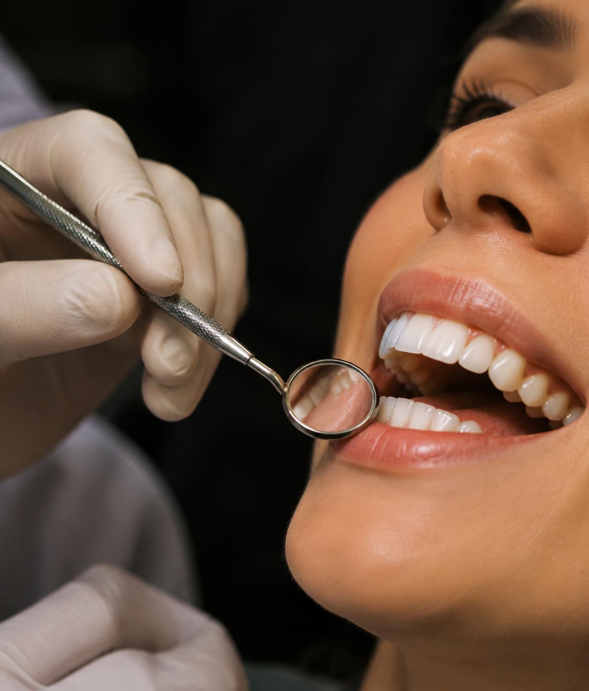 Dental check-up